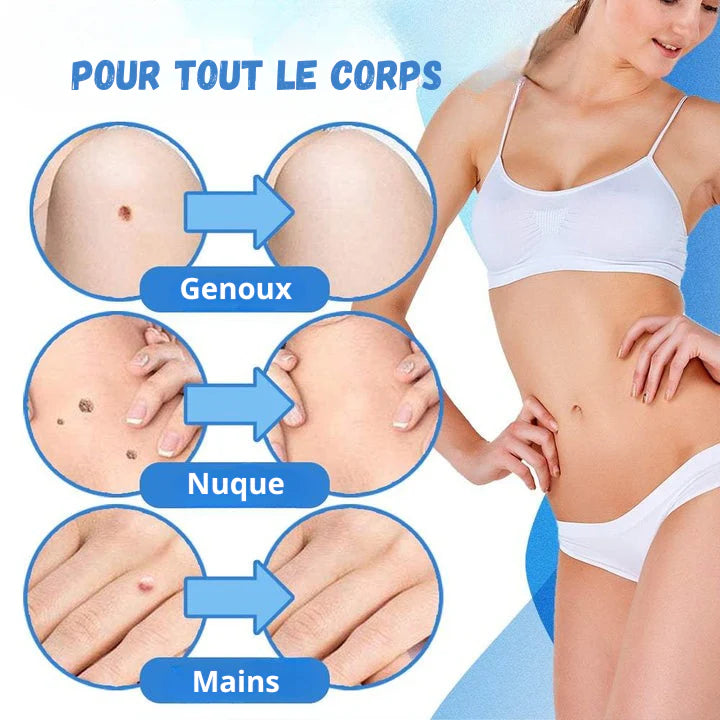 DermaSkin Pro™ - Dites Adieu aux Acrochordons