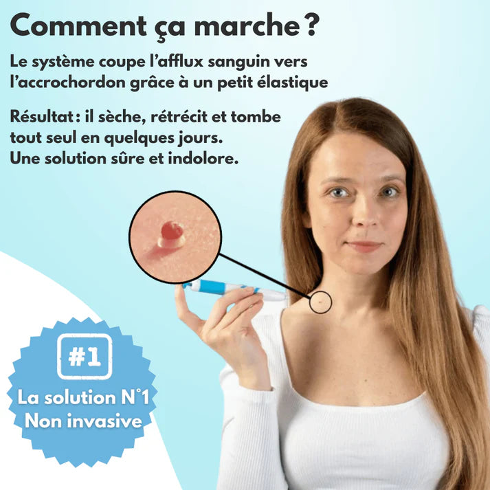 DermaSkin Pro™ - Dites Adieu aux Acrochordons