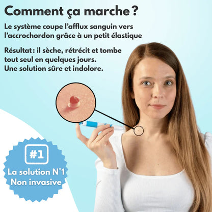 DermaSkin Pro™ - Dites Adieu aux Acrochordons